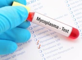 Анализ на определение днк mycoplasma pneumoniae/ chlamydophila pneumoniae в мазках со слизистой оболочки носоглотки методом пцр